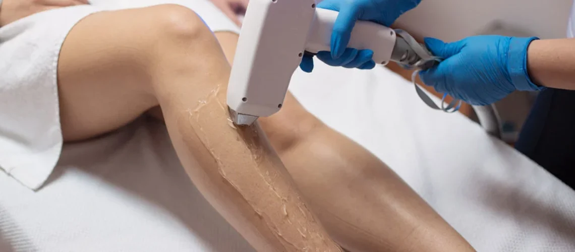 Laser Hair Removal Myths: Separating Fact from Fiction