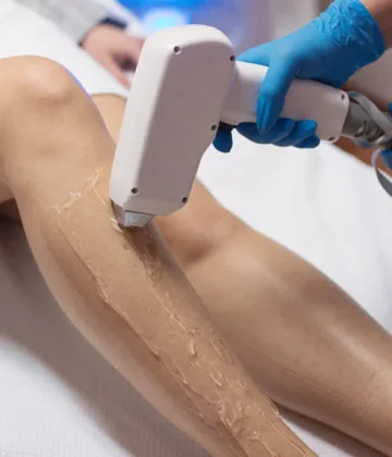 Laser Hair Removal Myths: Separating Fact from Fiction